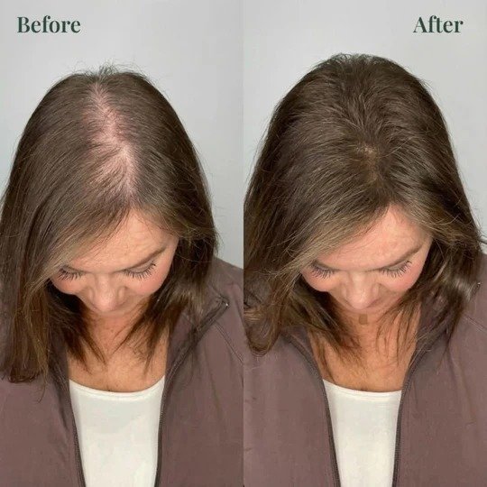 Tgideas Official | Rosemary Shampoo, Hair Oils & Natural Hair Tgideas Rosemary & Biotin Shampoo for Thinning Hair, Volumizing Shampoo for Fuller, Thicker Hair, Strengthening & Nourishing Formula with Root Lift,…