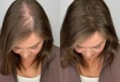 kerarose rosemary shampoo for hair growth