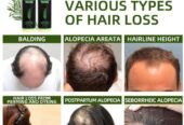 Tgideas Official | Rosemary Shampoo, Hair Oils & Natural Hair Tgideas Rosemary & Biotin Shampoo for Thinning Hair, Volumizing Shampoo for Fuller, Thicker Hair, Strengthening & Nourishing Formula with Root Lift,…