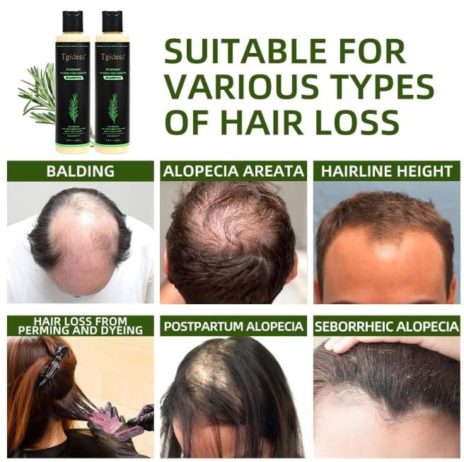 Tgideas Official | Rosemary Shampoo, Hair Oils & Natural Hair Tgideas Rosemary & Biotin Shampoo for Thinning Hair, Volumizing Shampoo for Fuller, Thicker Hair, Strengthening & Nourishing Formula with Root Lift,…
