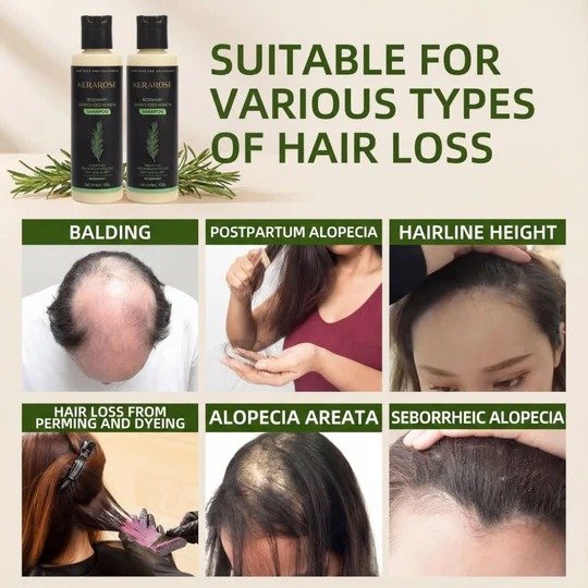 kerarose rosemary shampoo for hair growth
