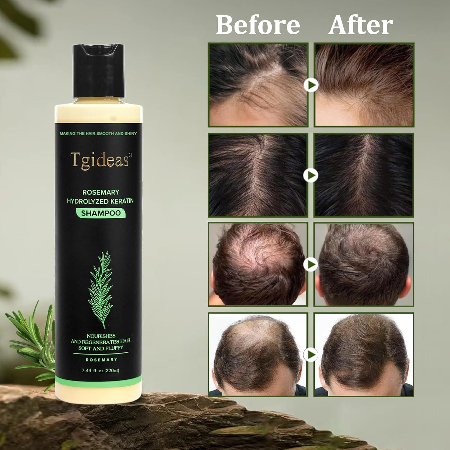 Tgideas Official | Rosemary Shampoo, Hair Oils & Natural Hair Tgideas Rosemary & Biotin Shampoo for Thinning Hair, Volumizing Shampoo for Fuller, Thicker Hair, Strengthening & Nourishing Formula with Root Lift,…