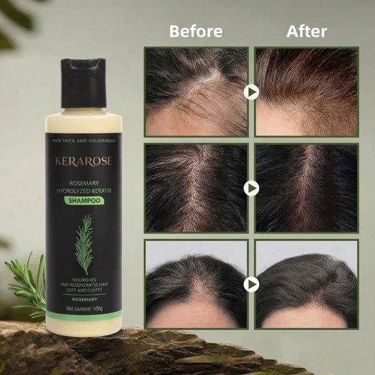 kerarose rosemary shampoo for hair growth