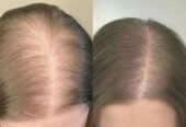 Tgideas Official | Rosemary Shampoo, Hair Oils & Natural Hair Tgideas Rosemary & Biotin Shampoo for Thinning Hair, Volumizing Shampoo for Fuller, Thicker Hair, Strengthening & Nourishing Formula with Root Lift,…