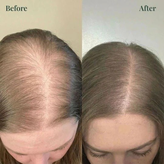 Tgideas Official | Rosemary Shampoo, Hair Oils & Natural Hair Tgideas Rosemary & Biotin Shampoo for Thinning Hair, Volumizing Shampoo for Fuller, Thicker Hair, Strengthening & Nourishing Formula with Root Lift,…